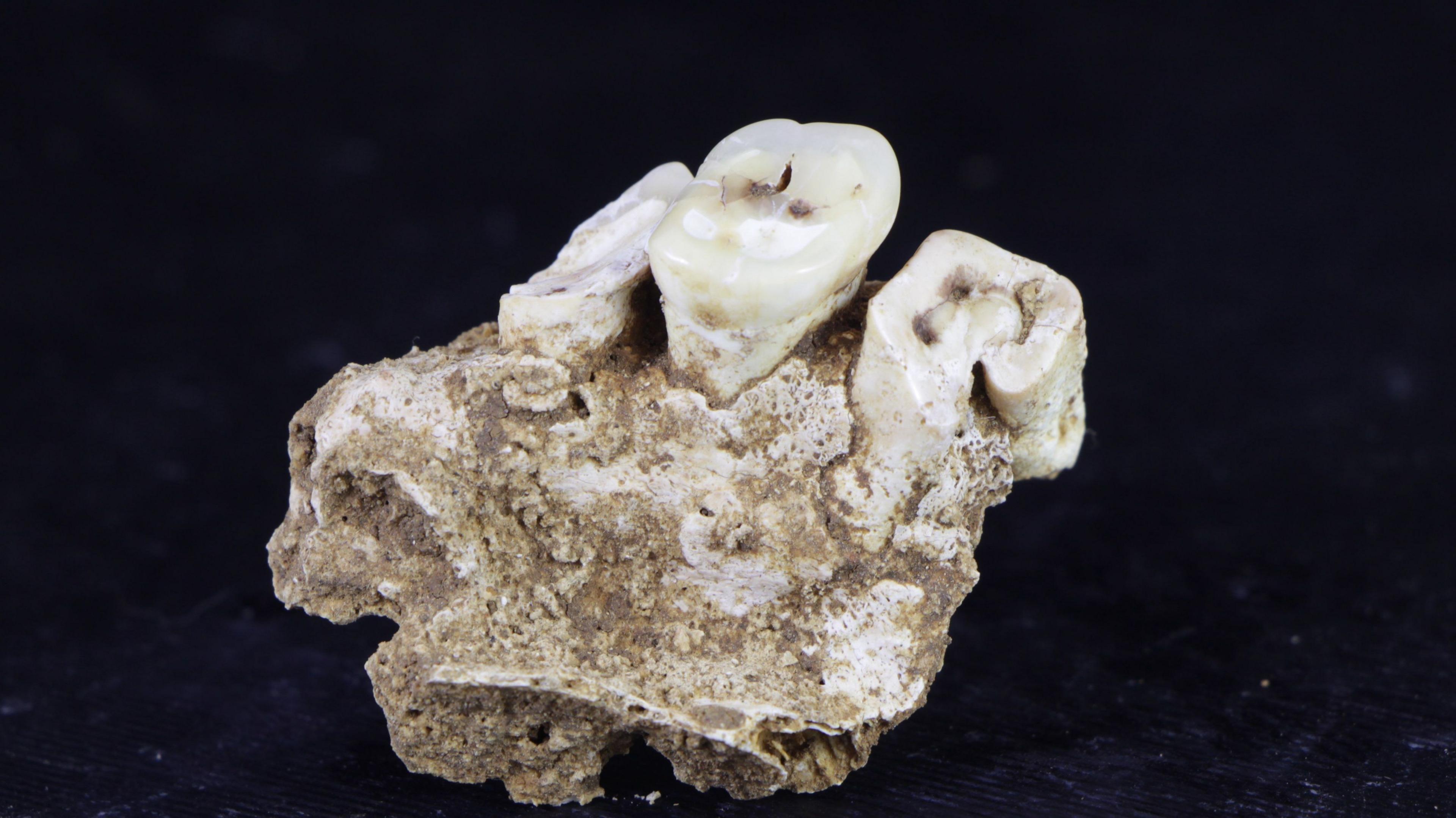 A small segment of the remains of a human jaw with three teeth. The background is black.