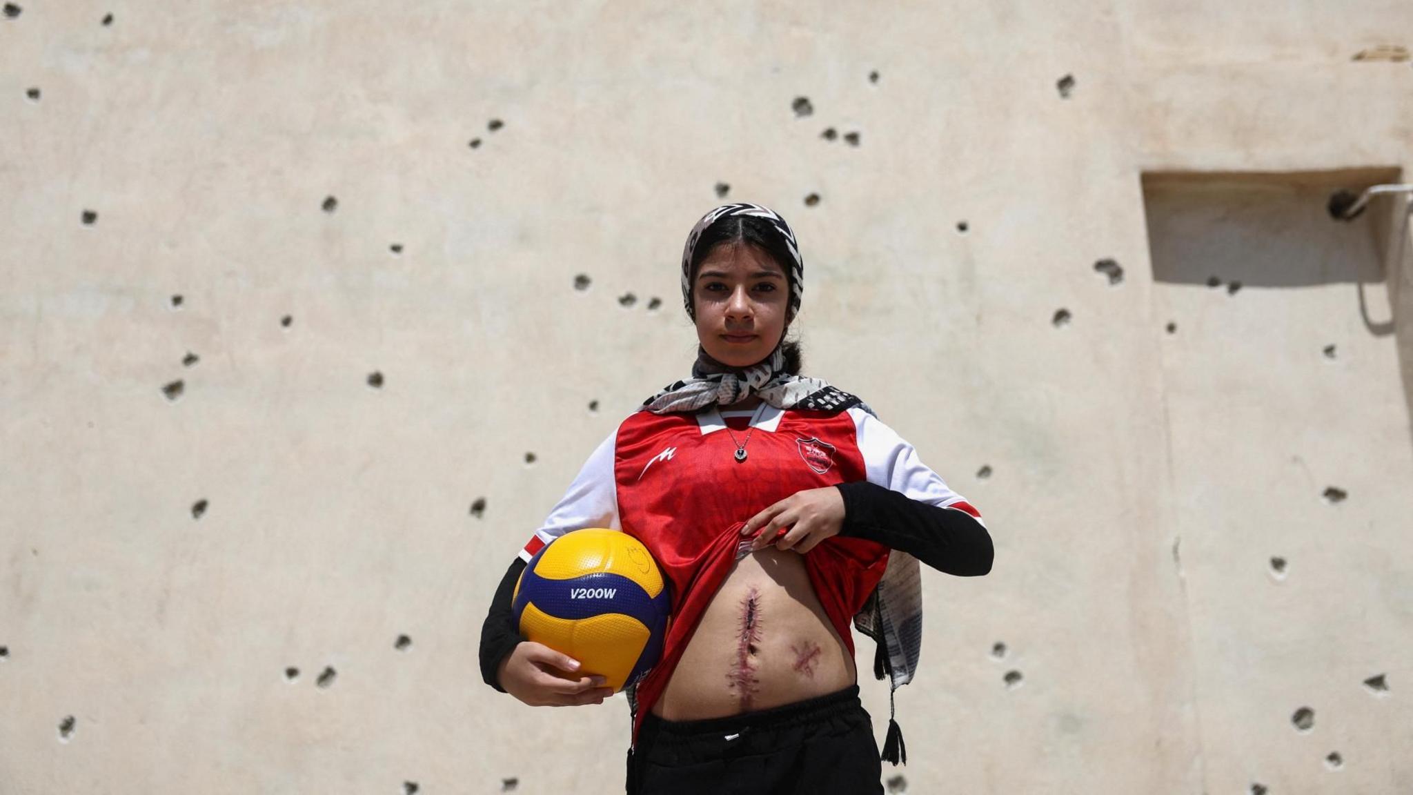 Anita Ghasemi, an Iranian girl injured in a strike on the Lamerd sports complex, shows wounds on her body while standing in front of a wall marked by shrapnel, in Lamerd, Iran (12 September 2026)