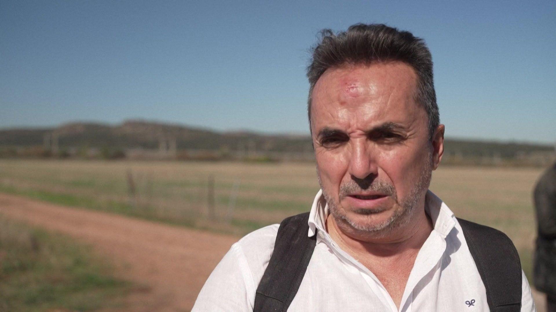 A man with short hair and a beard - with a bruise on his forehead - speaks to the media; he is wearing a white shirt with the black straps of what appears to be a backpack visible