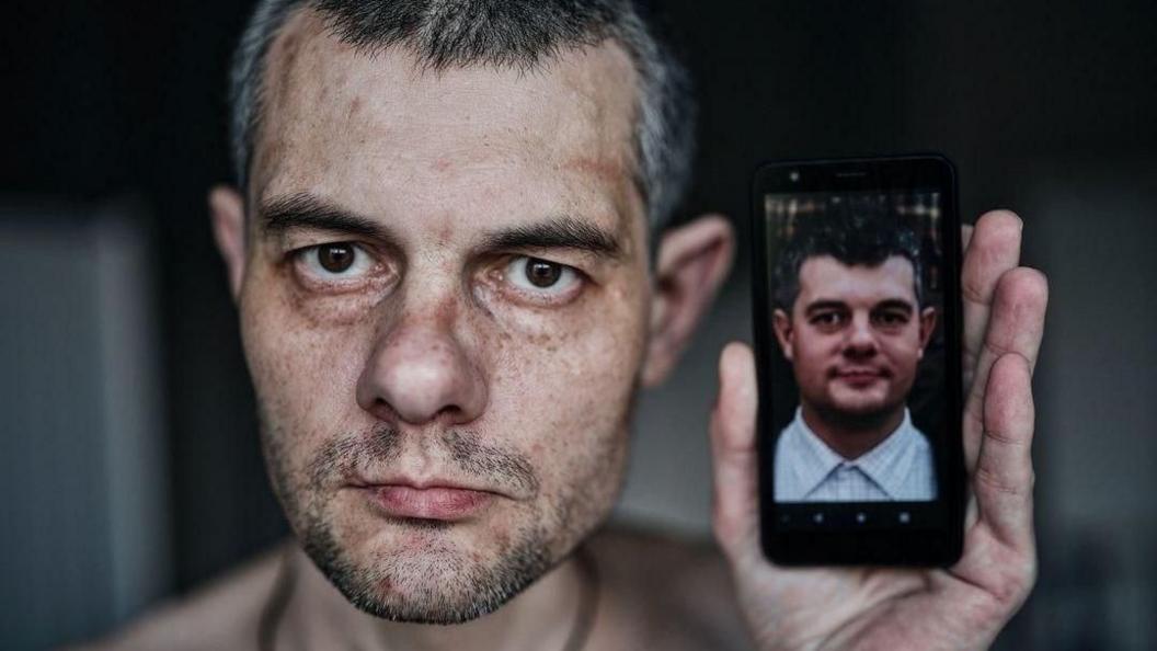 Ihor Shyshko looks directly into the camera. He is holding up and photos of himself pre-imprisonment in Russia to draw and contrast between his appearance then and now. He now looks older, thinner and has sustained some scars. His hair has turned grey.