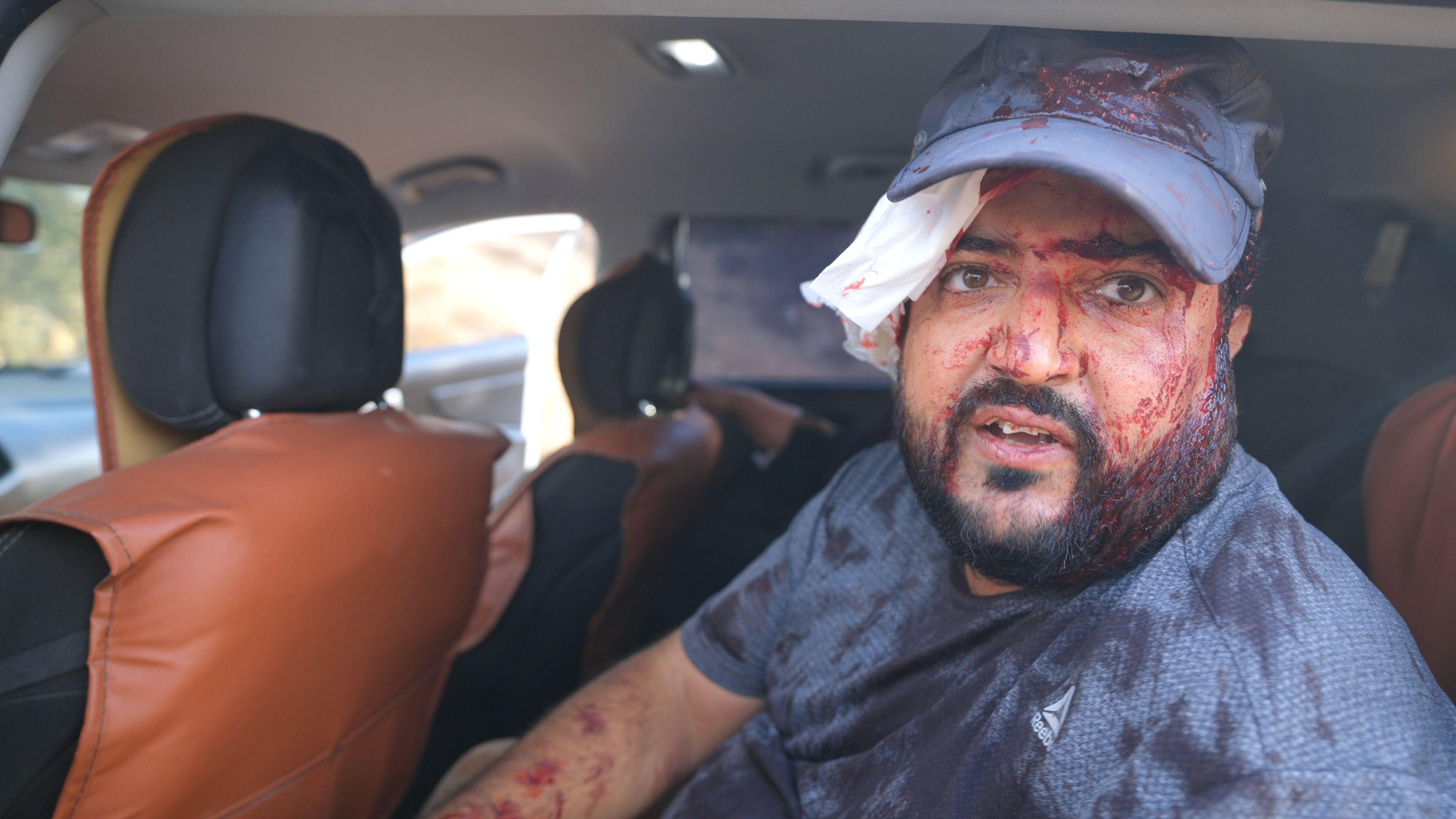 Majdi Fheed sits in the car with blood over his head and body