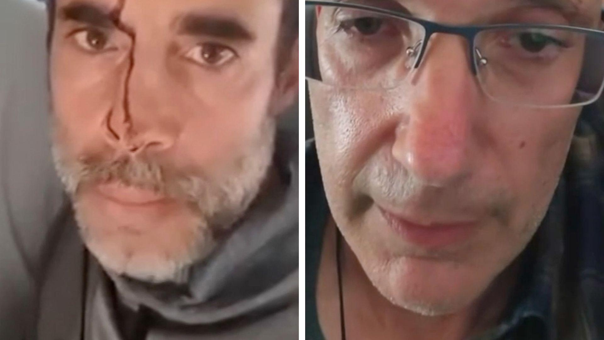 A split image of two men the left has a streak of blood on his face